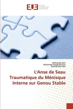 portada L'Anse de Seau Traumatique du Ménisque Interne sur Genou Stable (in French)
