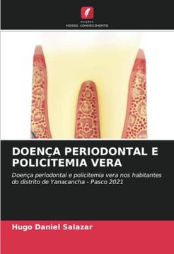 portada Doença Periodontal e Policitemia Vera: Doença Periodontal e Policitemia Vera nos Habitantes do Distrito de Yanacancha - Pasco 2021