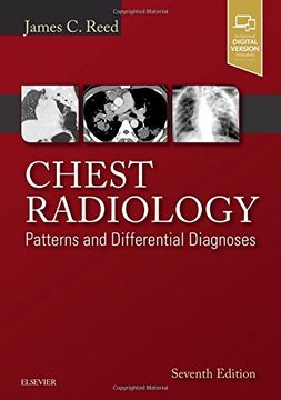 portada Chest Radiology: Patterns and Differential Diagnoses, 7e