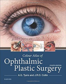 portada Colour Atlas of Ophthalmic Plastic Surgery, 4e 