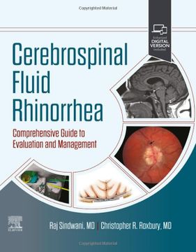 portada Cerebrospinal Fluid Rhinorrhea: Comprehensive Guide to Evaluation and Management (en Inglés)