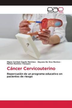 portada Cã Â¡ Ncer Cervicouterino (in Spanish)