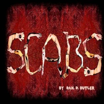 portada Scabs: Picking Apart The Facts (in English)