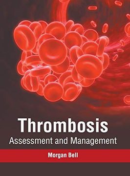 portada Thrombosis: Assessment and Management 