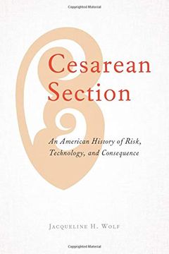 portada Cesarean Section: An American History of Risk, Technology, and Consequence (en Inglés)