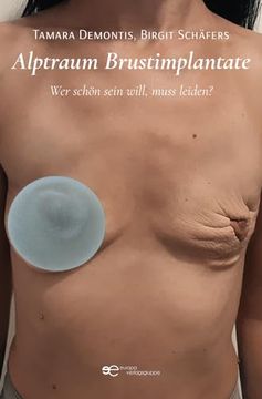 portada Alptraum Brustimplantate: Wer Schön Sein Will, Muss Leiden? (en Alemán)