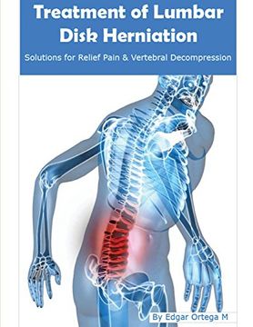 portada Treatment of Lumbar Disk Herniation: Back Pain Relief and Herniated Discs Solutions (in English)