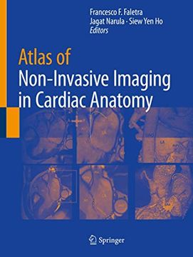 portada Atlas of Non-Invasive Imaging in Cardiac Anatomy (en Inglés)