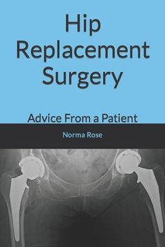 Hip Replacement Surgery: Advice From a Patient (en Inglés)