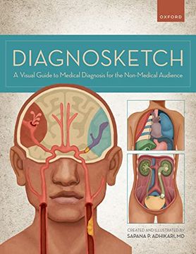 portada Diagnosketch: A Visual Guide to Medical Diagnosis for the Non-Medical Audience (in English)