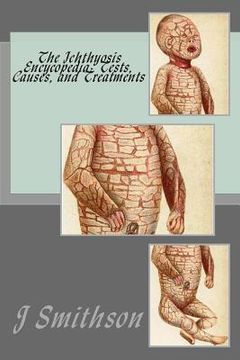 portada The Ichthyosis Encycopedia: Tests, Causes, and Treatments (en Inglés)