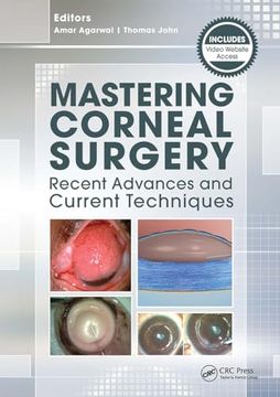 portada Mastering Corneal Surgery: Recent Advances and Current Techniques (in English)