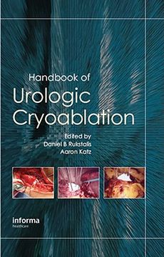 portada Handbook of Urologic Cryoablation (en Inglés)