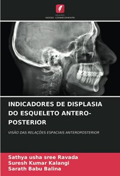 portada Indicadores de Displasia do Esqueleto Antero-Posterior: Visão das Relações Espaciais Anteroposterior (en Portugués)