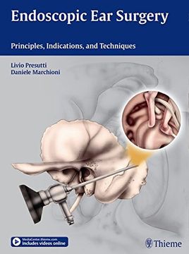 portada Endoscopic Ear Surgery: Principles, Indications, and Techniques