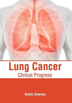 portada Lung Cancer: Clinical Progress