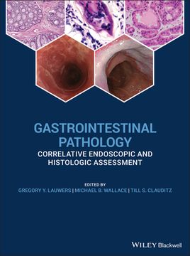 portada Gi Pathology and Endoscopic Biopsy: A Clinical Guide to Diagnosis (en Inglés)