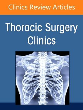 portada Lung Cancer 2021, Part 2, an Issue of Thoracic Surgery Clinics (Volume 31-4) (The Clinics: Surgery, Volume 31-4) (en Inglés)