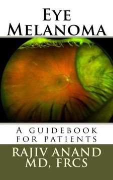 portada Eye Melanoma: A manual for patients
