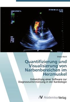 portada Quantifizierung und Visualisierung von Narbenbereichen im Herzmuskel: Entwicklung einer Software zur  Diagnoseunterstützung in der Kardiologie