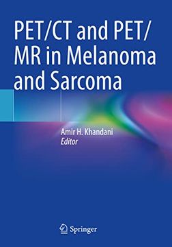 portada Pet/CT and Pet/MR in Melanoma and Sarcoma (en Inglés)