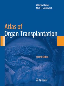 portada Atlas of Organ Transplantation (in English)