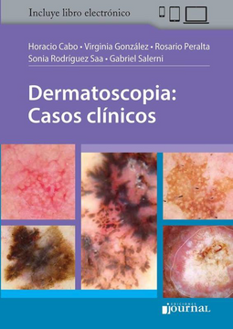 portada Dermatoscopia: Casos Clínicos