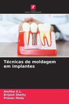 portada Técnicas de Moldagem em Implantes (en Portugués)