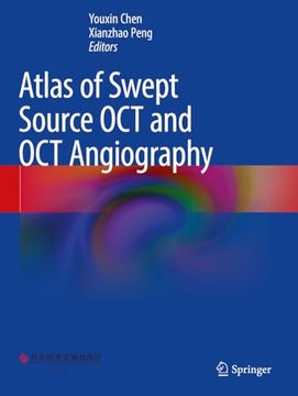 portada Atlas of Swept Source Oct and Oct Angiography
