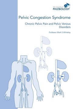 portada Pelvic Congestion Syndrome - Chronic Pelvic Pain and Pelvic Venous Disorders (en Inglés)