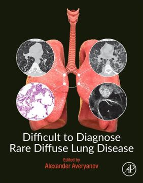 portada Difficult to Diagnose Rare Diffuse Lung Disease (en Inglés)