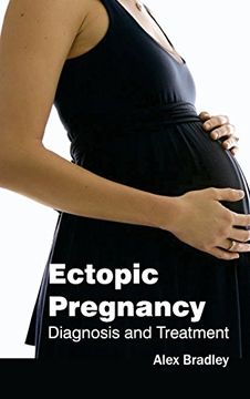 portada Ectopic Pregnancy: Diagnosis and Treatment (en Inglés)
