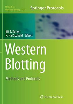 portada Western Blotting: Methods and Protocols (en Inglés)