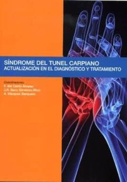 portada Sindrome del Tunel Carpiano: Actualizacion en el Diagnostico y tr Atamiento (in Spanish)