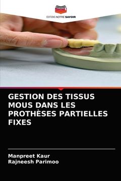 portada Gestion Des Tissus MOUS Dans Les Prothèses Partielles Fixes (en Francés)