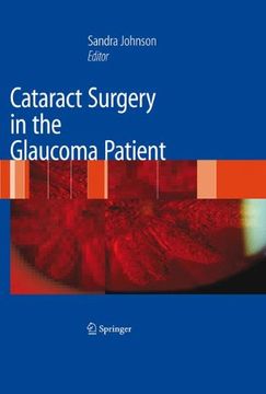 portada Cataract Surgery in the Glaucoma Patient (en Inglés)