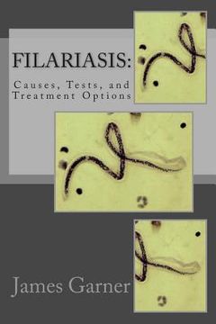 portada Filariasis: Causes, Tests, and Treatment Options (en Inglés)
