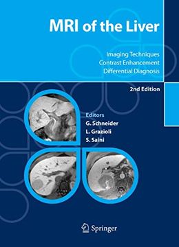 portada Mri of the Liver: Imaging Techniques, Contrast Enhancement, Differential Diagnosis 