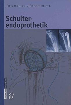 portada Schulterendoprothetik: Indikation, Implantate, Op-Technik, Nachbehandlung, Begutachtung