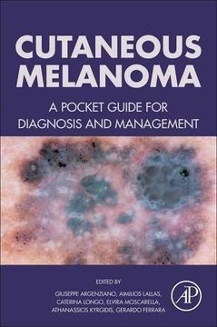 portada Cutaneous Melanoma: A Pocket Guide for Diagnosis and Management