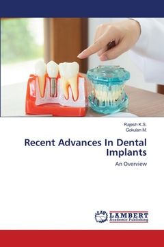 portada Recent Advances In Dental Implants (en Inglés)