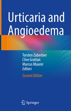 Urticaria and Angioedema (en Inglés)