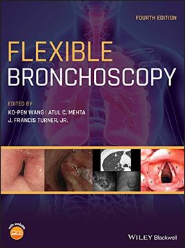 portada Flexible Bronchoscopy (en Inglés)