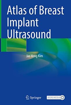 portada Atlas of Breast Implant Ultrasound (en Inglés)