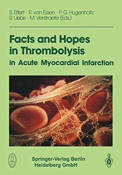 portada Facts and Hopes in Thrombolysis in Acute Myocardial Infarction (en Inglés)