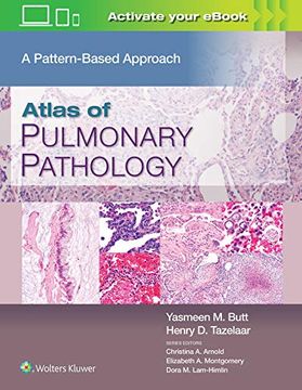portada Atlas of Pulmonary Pathology: A Pattern Based Approach (en Inglés)