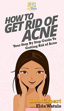 portada How to get rid of Acne: Your Step by Step Guide to Getting rid of Acne (en Inglés)