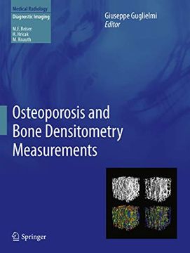 portada Osteoporosis and Bone Densitometry Measurements (en Inglés)