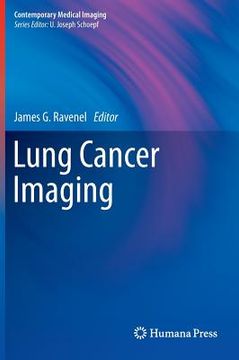 portada Lung Cancer Imaging (en Inglés)