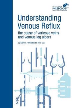 portada understanding venous reflux the cause of varicose veins and venous leg ulcers (en Inglés)